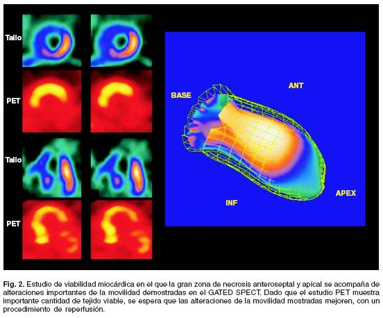 Resultado de imagen de La técnica combinada PET/CT es uno de los desarrollos más excitantes de la medicina nuclear y la radiología modernas