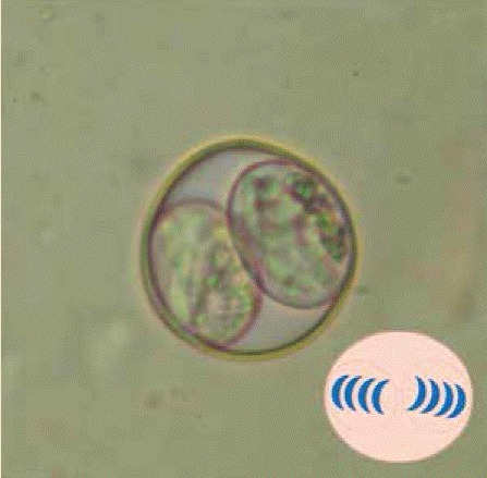 toxoplazma mi a norma Ascaris kiszállt egy felnőttből