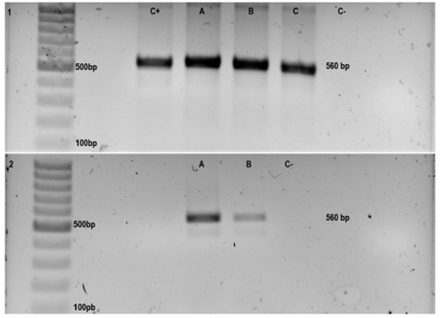 Toxoplasmoza – Generalitati, simptome, analize medicale recomandate in sarcina | Bioclinica