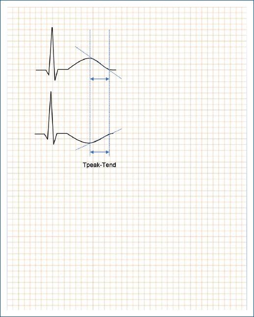 Relationship of the T-wave Tpeak-Tend interval with conduction system ...