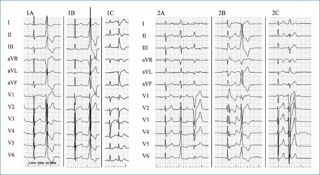 Posicionamiento mexicano para el tamizaje y la evaluación ...