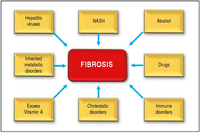 Management Strategies for Liver Fibrosis