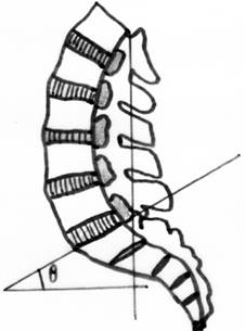 Grados De Flexión De La Columna