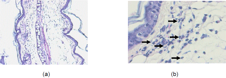 
								Mouse ear skin. H-E. 100x (a) and 400x (b). Effect of TPA, without the addition of antiinflammatory. There is a marked increase in neutrophils in the dermis (arrows, representative of at least 40 cells in the field) 
							