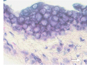 
								Mouse ear skin. H-E. 400x. Application of the organic fraction of the hydroalcoholic extract of S. babylonica. As can be seen, the presence of inflammatory cells in the dermis is minimal (arrow)
							