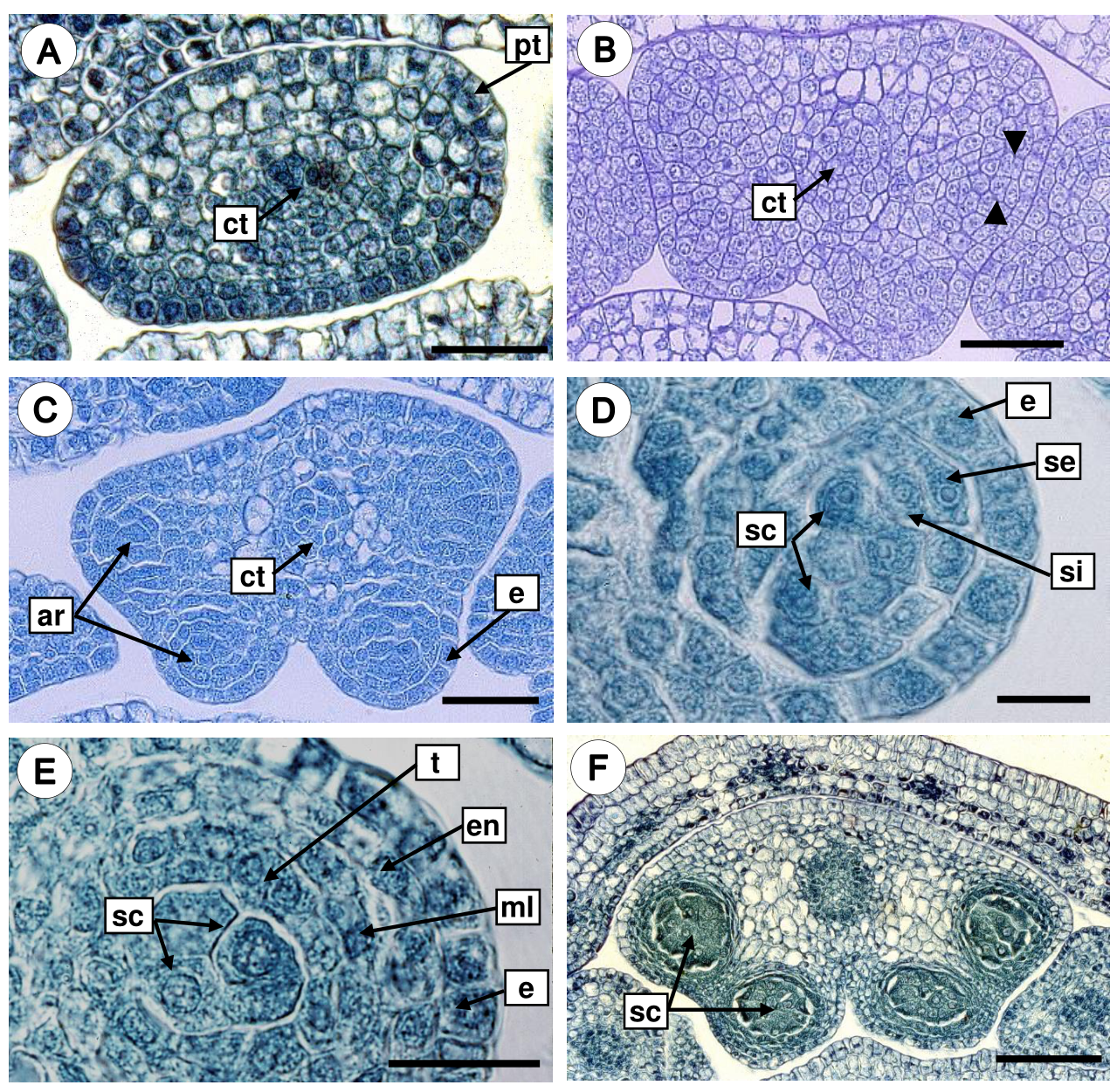 Microsporogenesis, microgametogenesis, and pollen grain morphology of ...