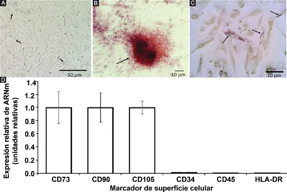Tratamiento regenerativo con células madre mesenquimales provenientes