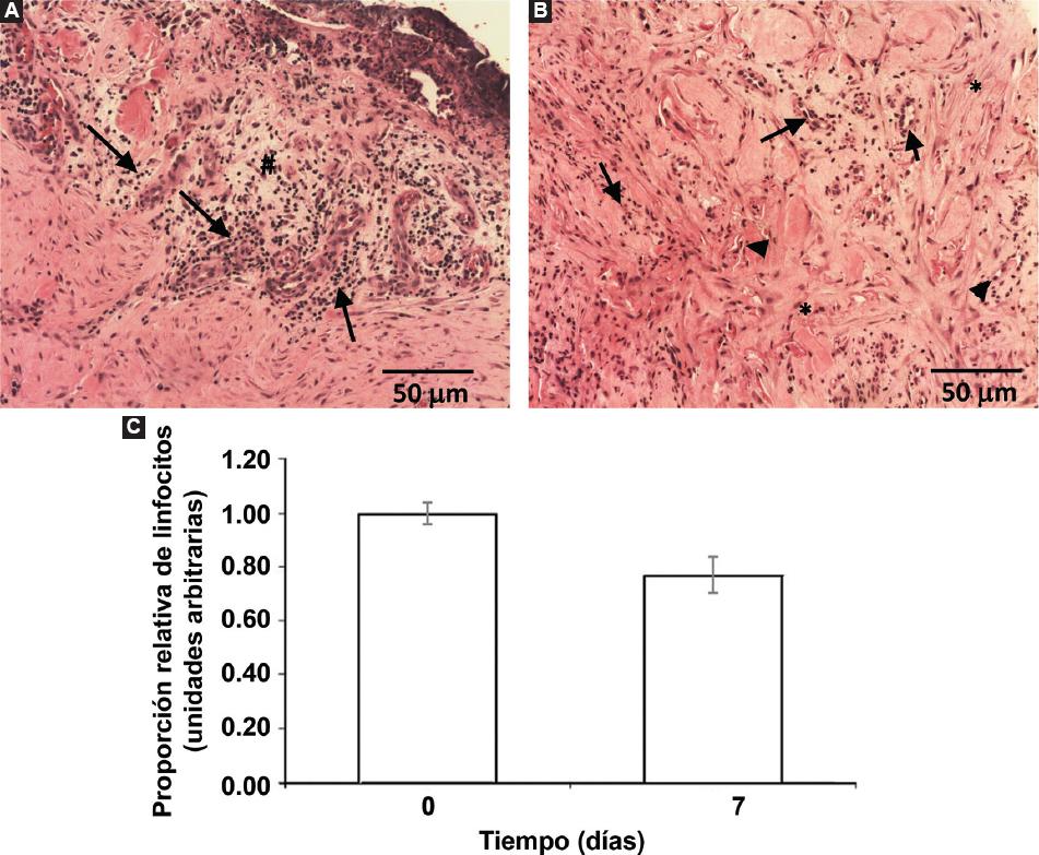 Tratamiento regenerativo con células madre mesenquimales provenientes