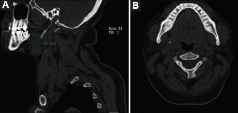 Boîte De Film Géocaching – 37x51 Mm – Micro, Plusieurs Couleurs – Par 1 Ou 6