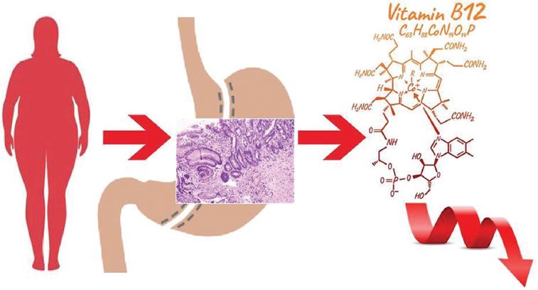Evaluation of the response to vitamin B12 supplementation in patients ...