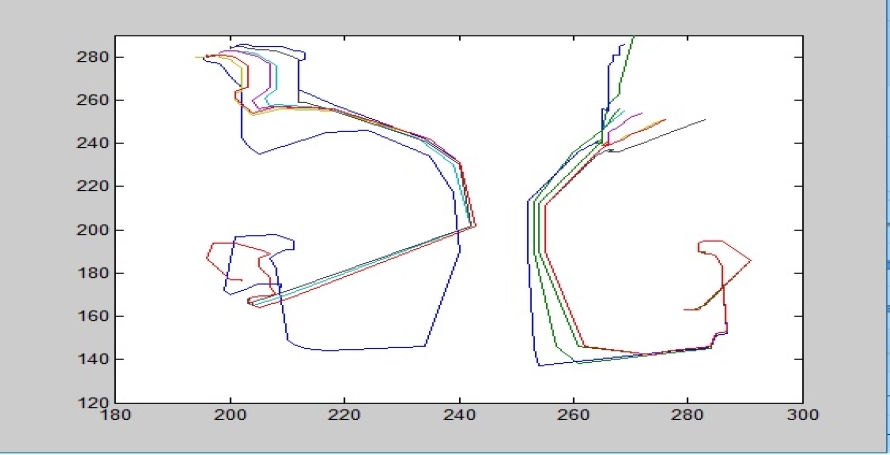 Gesture Recognition System For Isolated Word Sign Language Based On key ...