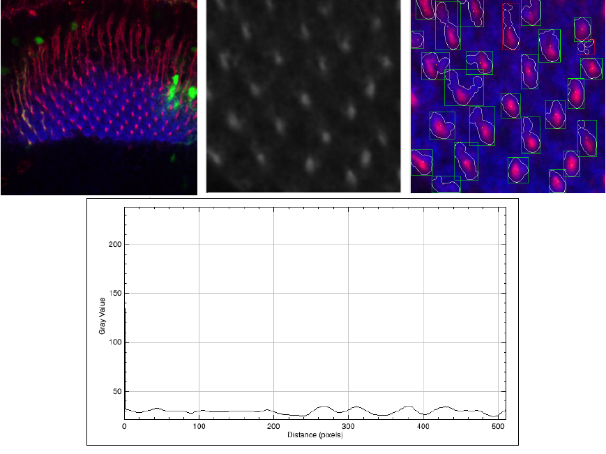 Detection, Counting, and Classification of Visual Ganglia Columns of ...