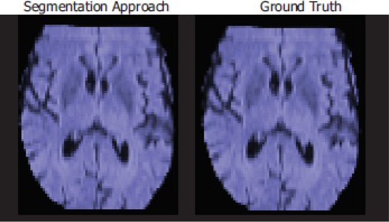 A System for Brain Image Segmentation and Classification Based on Three ...