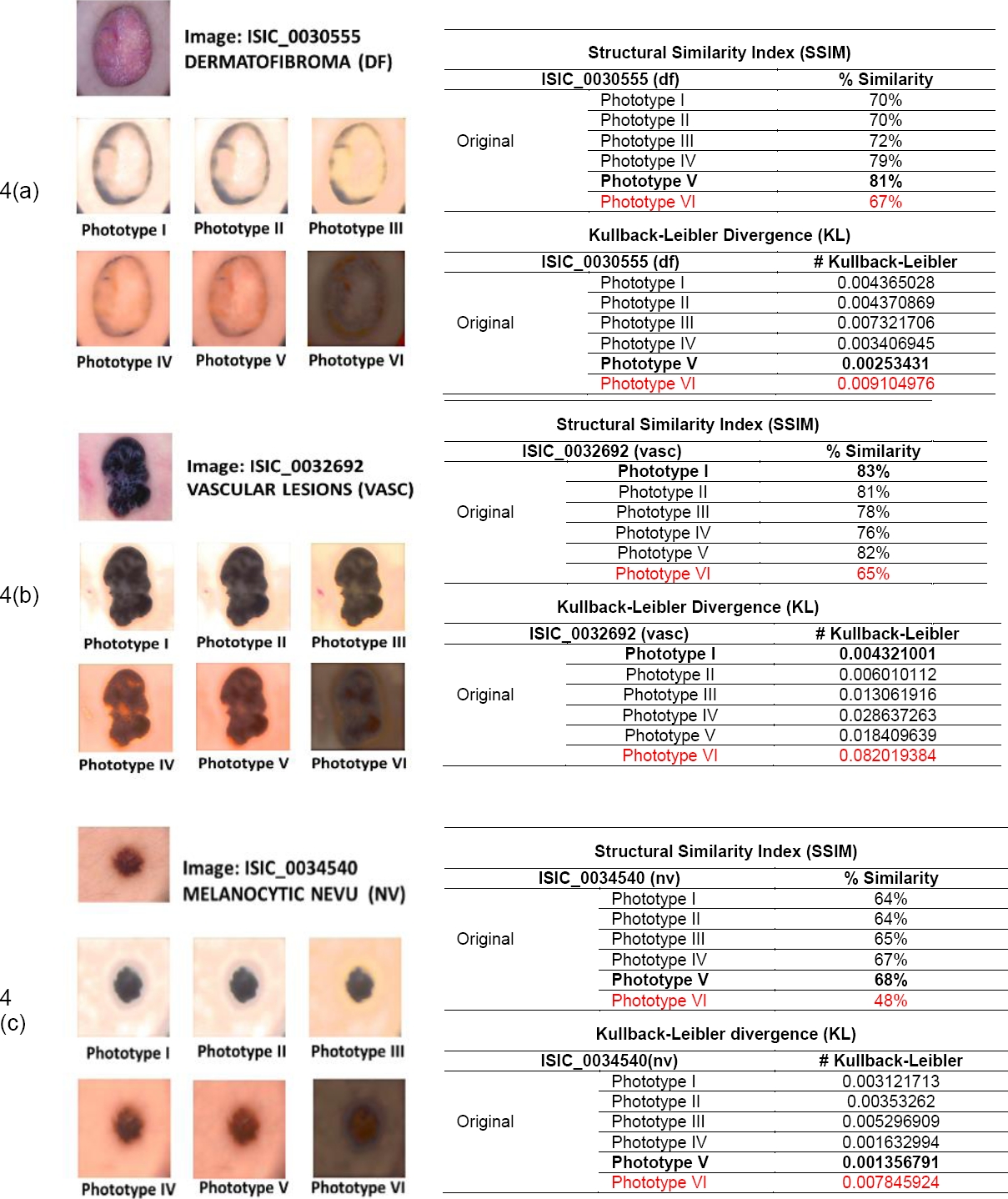 Style Transfer Technique for Dermatological Imaging of Skin Lesions in ...