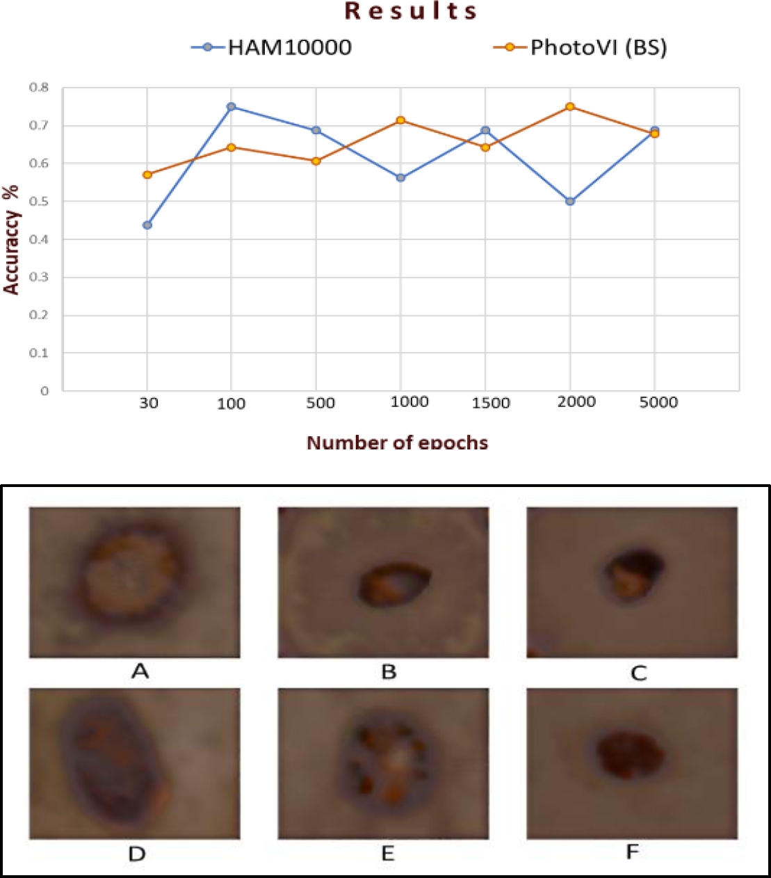 Style Transfer Technique for Dermatological Imaging of Skin Lesions in ...