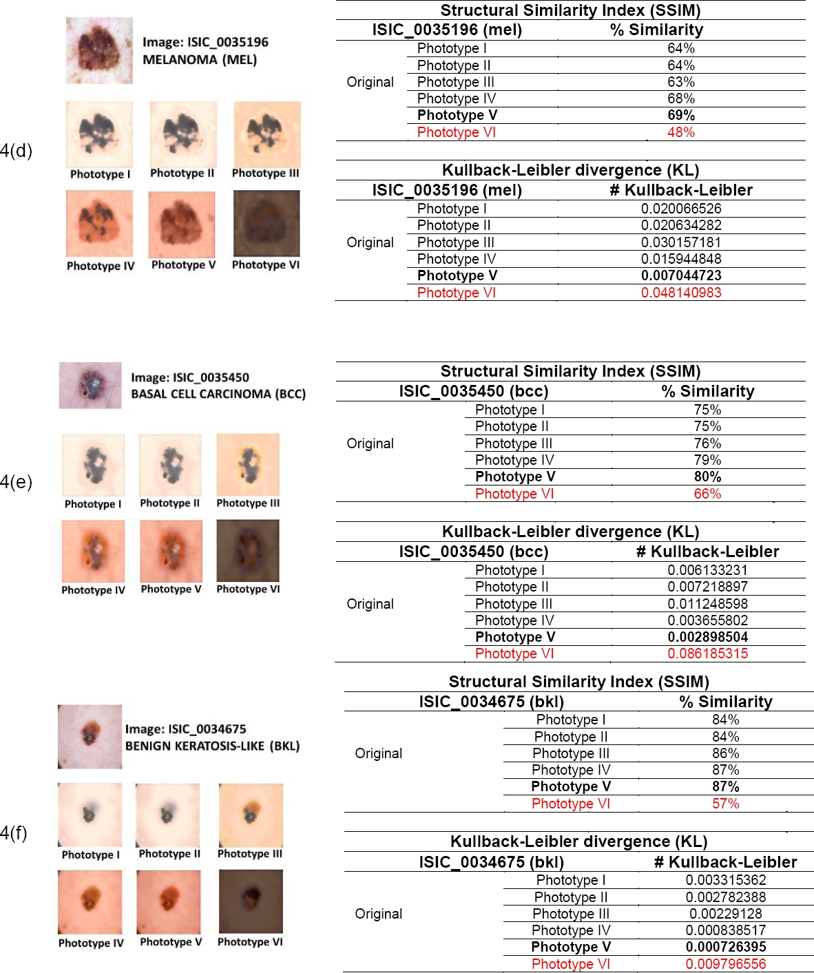 Style Transfer Technique for Dermatological Imaging of Skin Lesions in ...