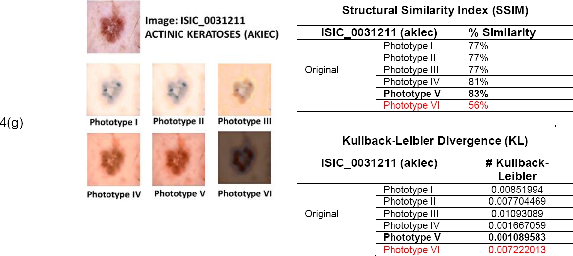 Style Transfer Technique for Dermatological Imaging of Skin Lesions in ...