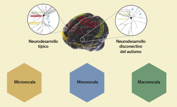 Trastorno del espectro autista (TEA)