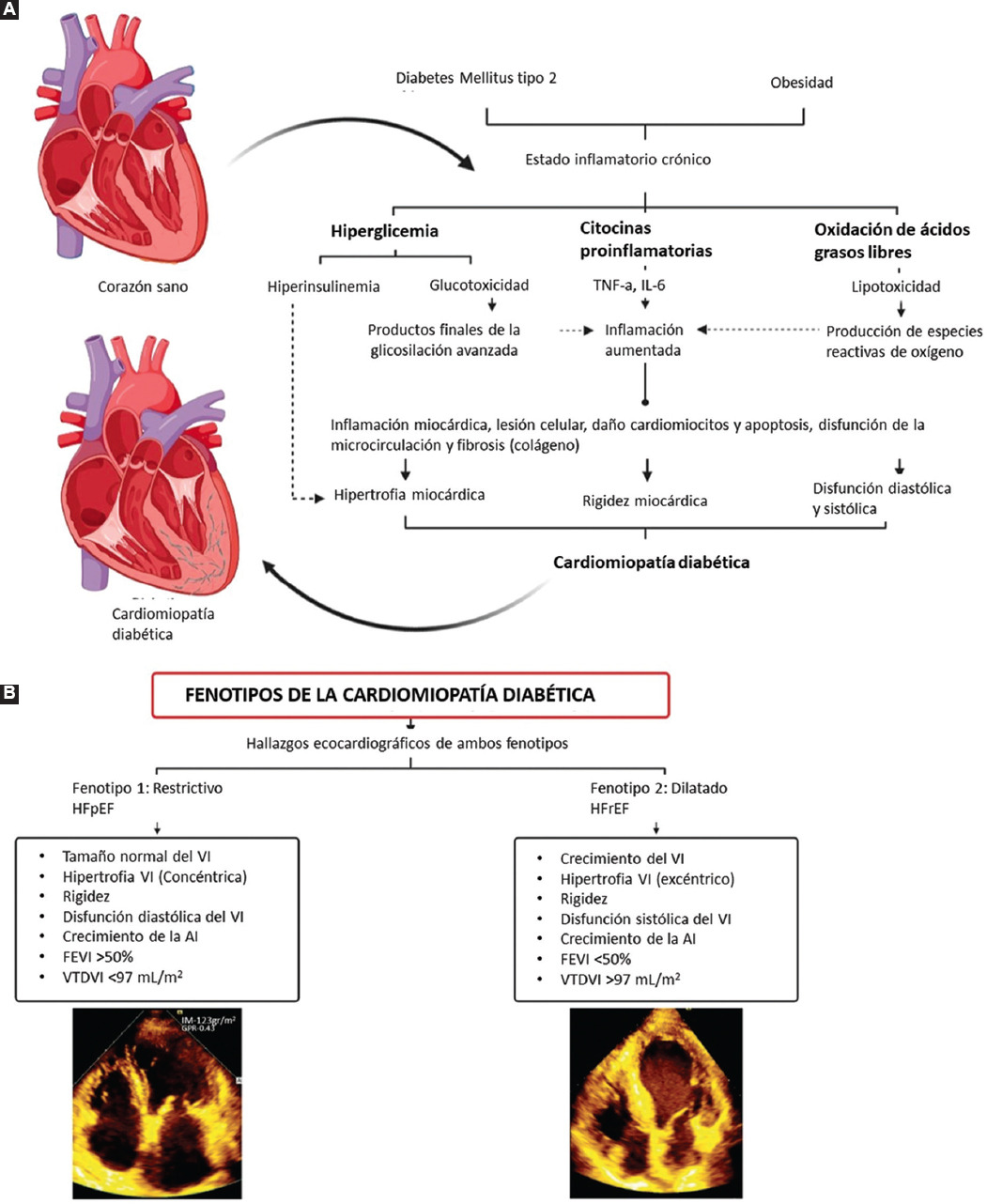 Métodos diagnósticos cardiovasculares en pacientes con diabetes