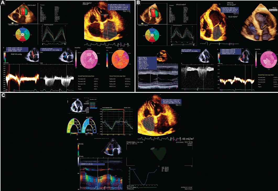 Métodos diagnósticos cardiovasculares en pacientes con diabetes