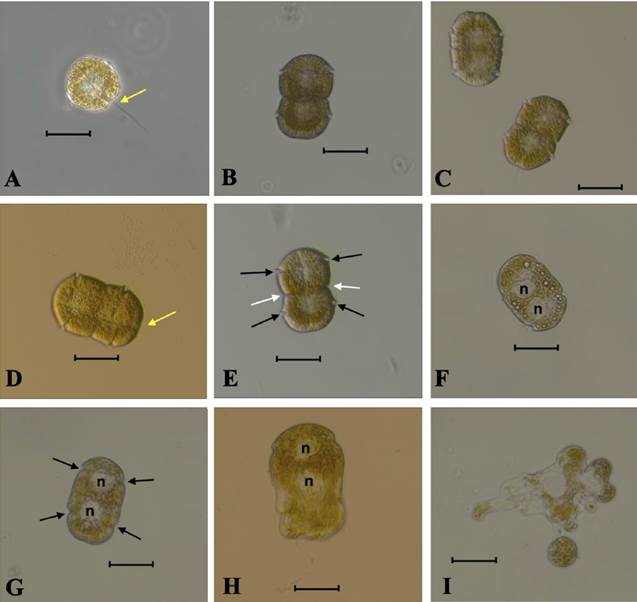 
						Light microphotographs of Polykrikos hartmannii from Izmir Bay (A-I): single cells of Polykrikos hartmannii (A); ventral view of a two-celled chain showing general cell shape, cingulum, and the connection between the two zooids (B-E); a colony stressed by longer exposure in deeper focus, showing nucleus (n) (F, G) and lysis of the cell (H, I). Black arrows show two transverse furrows, white arrows show the visible border between the two zooids, and yellow arrows show the longitudinal flagellum. Scale bars: 40 μm
					