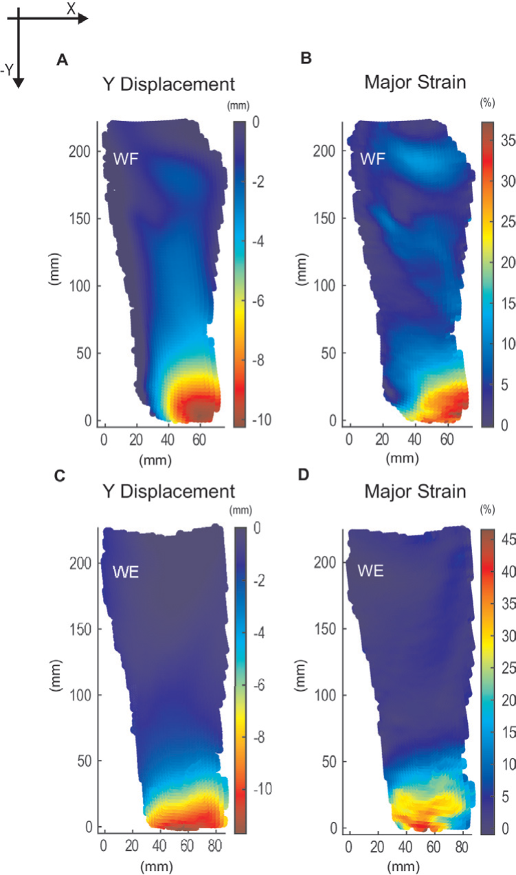 Quantitative and objective full-field strain measurements of healthy ...