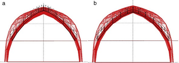 Analytical and Numerical funicular analysis by means of the Parametric ...