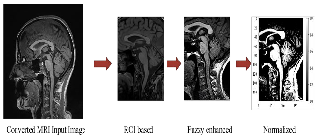 
							Summary of steps involved in pre-processing pipeline.
						