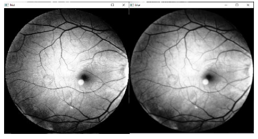 Diagnose eyes diseases using deep learning algorithms