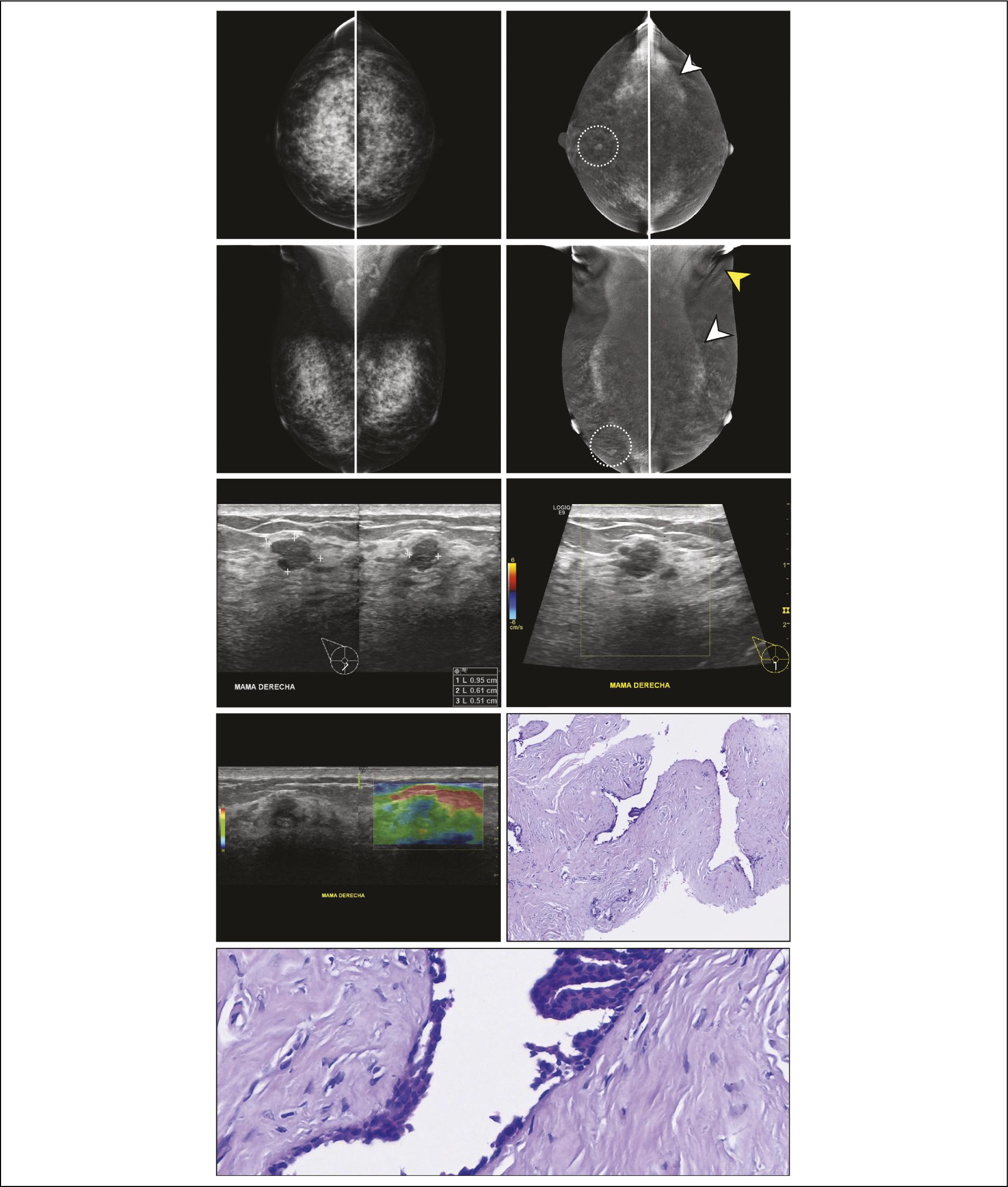 Bi Rads Cem Standardized structured breast CEM report based on BI-RADS v2025: a ...
