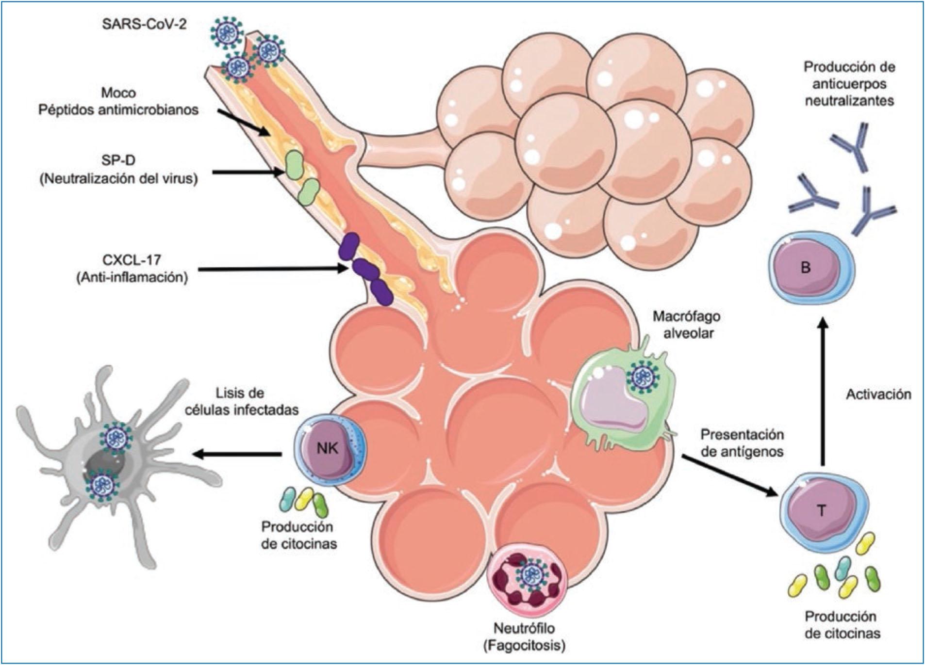 Inmunopatología de la infección por SARS-CoV-2