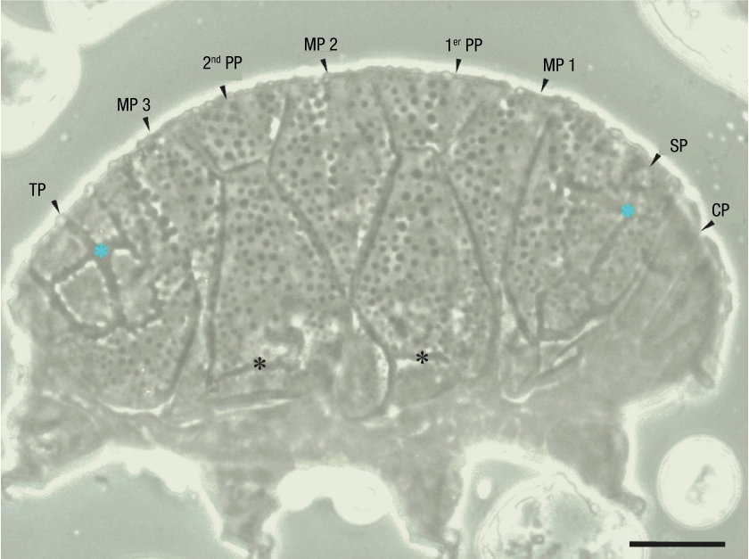 
								Dorsal region of Kristenseniscus kofordi.
									Blue asterisks indicate band-like thickenings that are
									interrupted, while the black asterisks indicate longitudinal
									band-like thickenings. Scapular plate (SP), cephalic plate (CP),
									median plate (MP), plate pair (PP), terminal plate (TP). Scale
									20 µm.
							