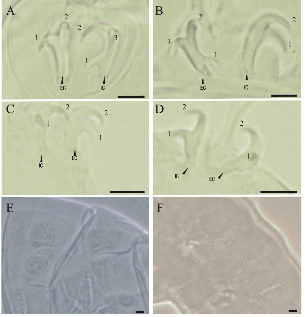 
								Diagnostic characters of the collected specimens of
										Milnesium cf. cassandrae A) Claw
									configuration [2-3] on leg III and B) claw configuration [3-2]
									on leg VI in adult specimens. C) Claw configuration [2-2] on leg
									II and D) Claw configuration [2-2] on leg VI in juvenile
									specimens. E) Reticular pattern of the dorsal cuticle in adult
									specimens and F) in juveniles. Internal claw (IC), external claw
									(EC). Scale = 20 µm.
							