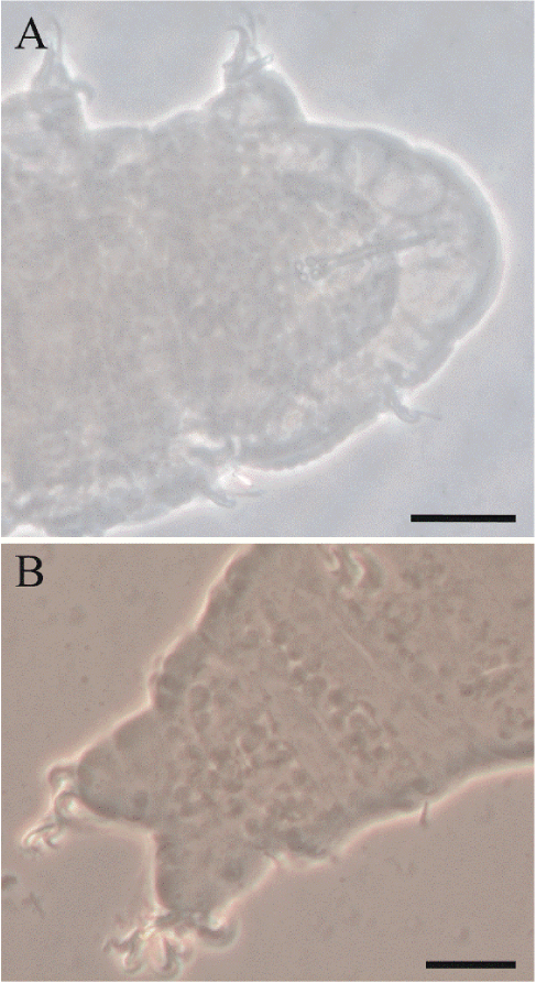 
								A) Sculpted cuticle of specimens identified as
										Ramazzottius cf. baumanni. B) Gibbosities
									of the dorsal cuticle of specimens identified as
										Macrobiotus cf.
										semmelweisi. Scale = 20 µm.
							