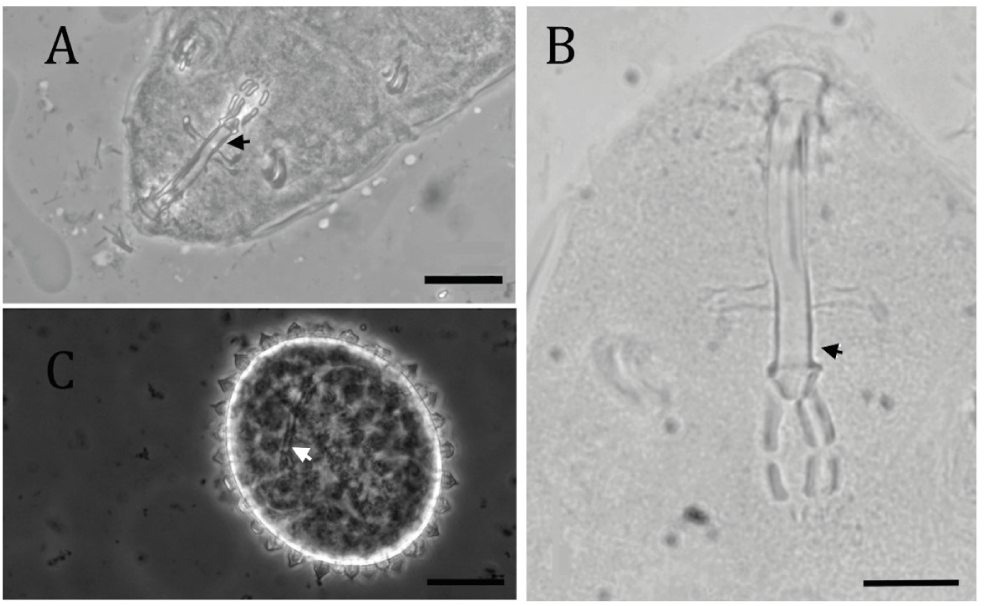 
								Buccal apparatus (A and B) and embryonated egg (C) of
									specimens identified as Macrobiotus alvaroi.
									Arrows indicate thickening at the end of the buccal tube. Scale
									= 20 µm.
							