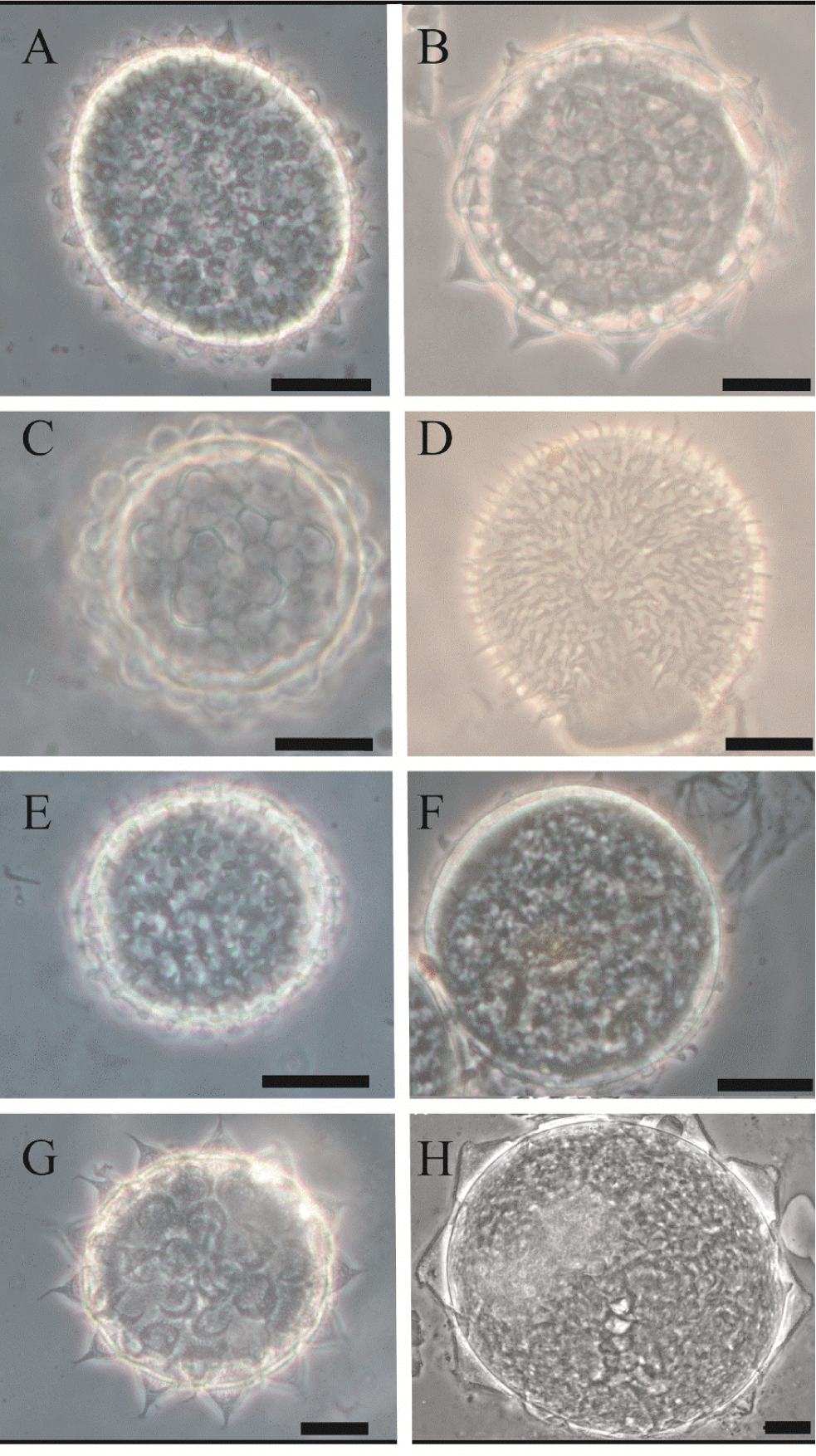 
								Eggs of the taxa identified during the study. A)
										Macrobiotus savai, B)
										Macrobiotus cf. polyopus,
									C) Macrobiotus cf. ocotensis,
									D) Macrobiotus sp. (hufelandi
									group), E) Minibiotus cf.
										intermedius, F)
										Macrobiotus cf.
										semmelweisi, G) Mesobiotus
									cf. pseudopatiens, H)
										Paramacrobiotus cf. savai.
									Scale 20 µm.
							