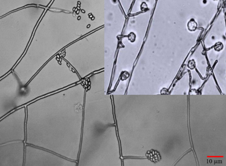 
							Solitary phialides and conidia of Simplicillium sp. (CATIE strain).
						