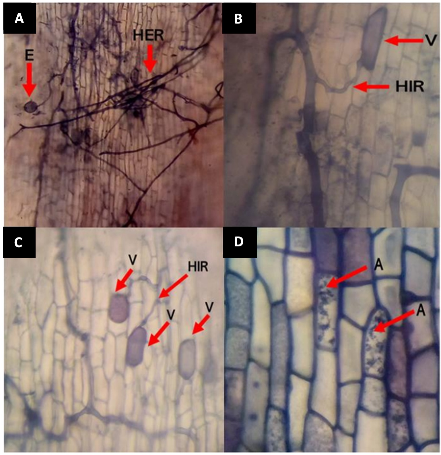 
							Mycorrhizal structures in P. campechiana roots. A= E spore, HER germ tube connected to the network of extra-radical hyphae; B= V vesicle, HIR network of intraradical hyphae; C= V group of interconnected vesicles, HIR network of intraradical hyphae; D= A arbuscules inside the cells of the cortex. (Saplings with root pruning before transplanting to the field and collected 80 days after planting) (Galvis-Muñoz et al., 2019).
						