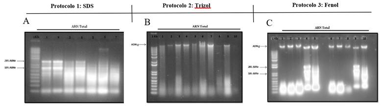 extraction adn phenol chloroforme protocole
