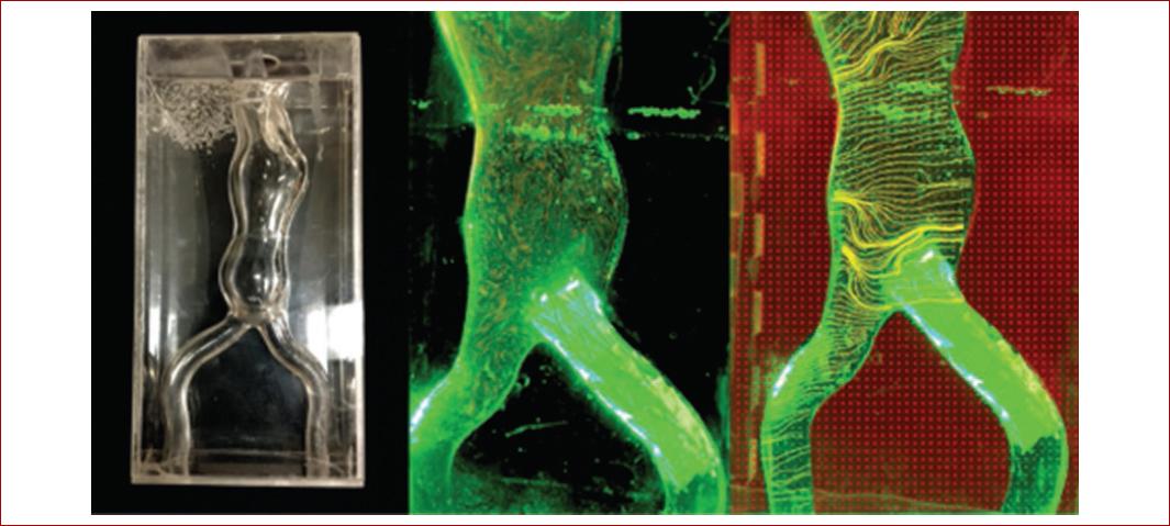 Trends of 3D bioprinting in vascular surgery