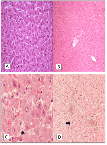 Preliminary study of ivermectin residues in bovine livers in the Bogota ...