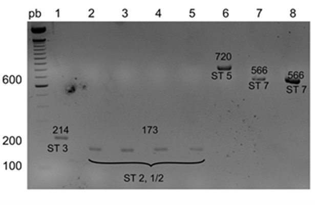 Molecular prediction of serotypes of Streptococcus suis isolated from ...