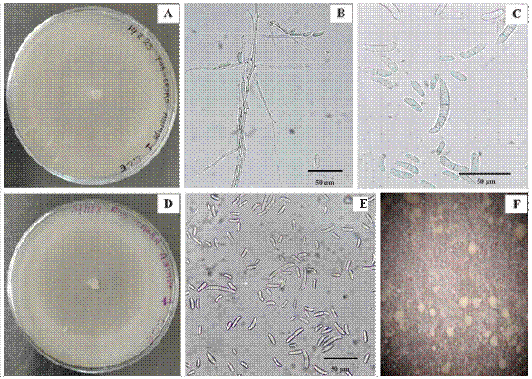 
							A and D) View of 14-day-old Fusarium solani isolated from Cedrela odorata and Swietenia macrophylla, B) Septate mycelium and microconidia of F. solani, C) Macroconidia (3-4 septa) and microconidia (0-1 septum) of F. solani observed at 100X magnification, E) Macroconidia and microconidia observed at 40X magnification, and F) Sporodochia.
						