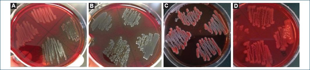 Colorless Colonies Comparative study between diarrheagenic Escherichia coli virotypes from ...