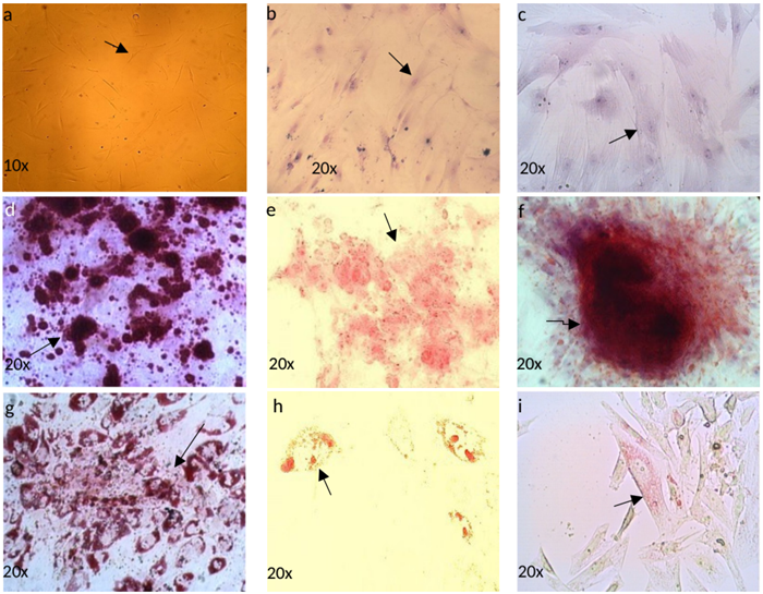 Comparación entre Células Troncales Mesenquimales obtenidas de Médula