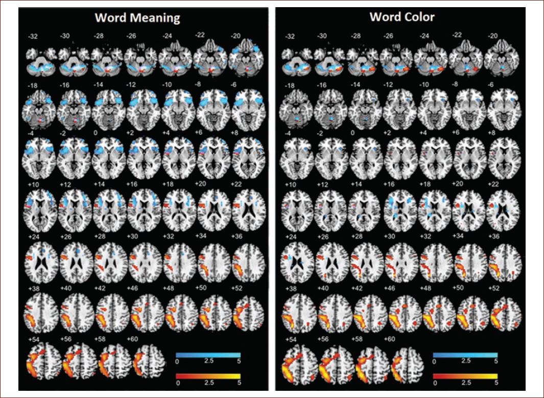 Neurofunctional activation patterns reflect differences in cognitive ...
