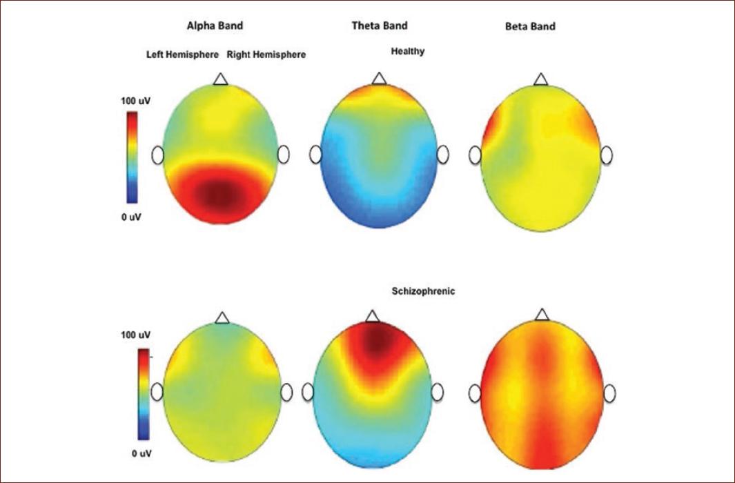 Electroencephalographic activity during sentence production in healthy ...