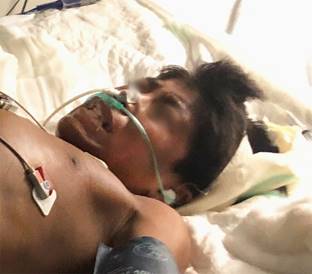 
						Trismus y risa sardónica en paciente con tétanos.
					