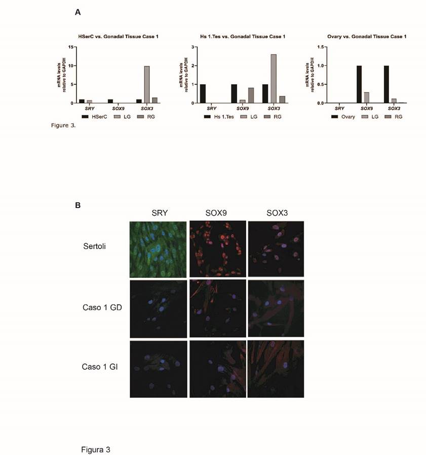 Cytogenetic and molecular characterization in gonadal tissue of ...