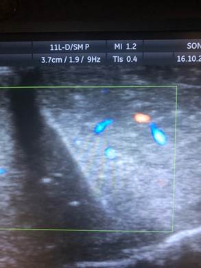 
							Ecografía de pene en corte transversal
						